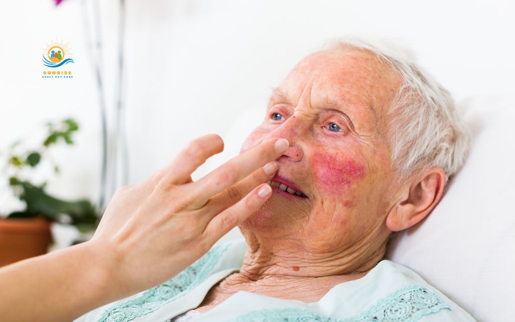 Why nosebleeds are more common after age 65